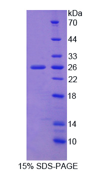 淀粉样蛋白β前体蛋白结合蛋白2(APPBP2)重组蛋白,Recombinant Amyloid Beta Precursor Protein Binding Protein 2 (APPBP2)