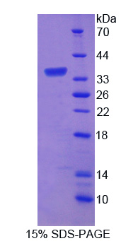 淀粉样蛋白β前体蛋白结合蛋白B3(APBB3)重组蛋白,Recombinant Amyloid Beta Precursor Protein Binding Protein B3 (APBB3)