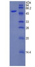 淀粉樣前體蛋白(APP)重組蛋白,Recombinant Amyloid Precursor Protein (APP)