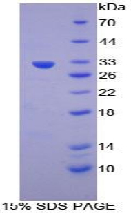 凋亡关联酪氨酸激酶(AATK)重组蛋白,Recombinant Apoptosis Associated Tyrosine Kinase (AATK)