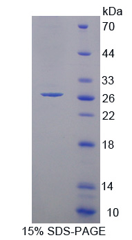 凋亡相关因子(FAS)重组蛋白,Recombinant Factor Related Apoptosis (FAS)