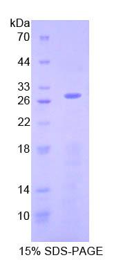 凋亡诱导因子(AIF)重组蛋白,Recombinant Apoptosis Inducing Factor (AIF)