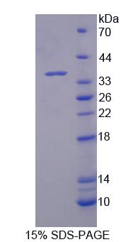 动力蛋白轴丝重链11(DNAH11)重组蛋白,Recombinant Dynein, Axonemal, Heavy Chain 11 (DNAH11)