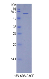 端粒重复结合因子1(TERF1)重组蛋白,Recombinant Telomeric Repeat Binding Factor 1 (TERF1)