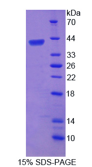 端粒重复结合因子2(TERF2)重组蛋白,Recombinant Telomeric Repeat Binding Factor 2 (TERF2)