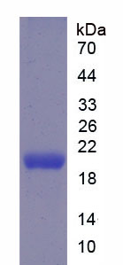 短腭肺鼻腔上皮癌关联蛋白2(SPLUNC2)重组蛋白,Recombinant Short Palate, Lung And Nasal Epithelium Carcinoma Associated Protein 2 (SPLUNC2)