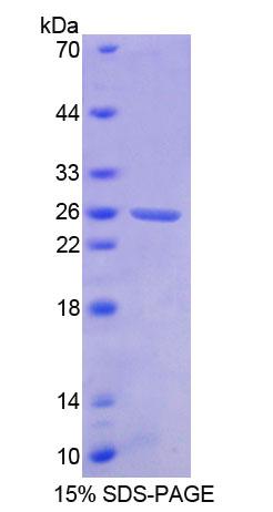 斷裂點簇集群區(qū)(BCR)重組蛋白,Recombinant Breakpoint Cluster Region (BCR)