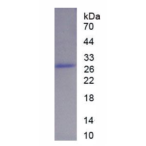 蛋白激酶Cζ(PKCz)重组蛋白