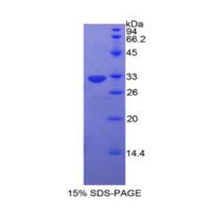 蛋白激酶Cη(PKCh)重组蛋白,Recombinant Protein Kinase C Eta (PKCh)