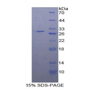 蛋白激酶D2(PKD2)重组蛋白