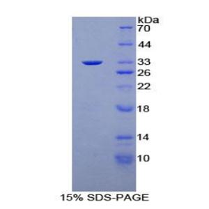 蛋白激酶N1(PKN1)重组蛋白,Recombinant Protein Kinase N1 (PKN1)