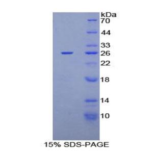 蛋白激酶N2(PKN2)重组蛋白,Recombinant Protein Kinase N2 (PKN2)