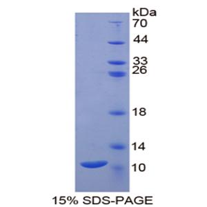 蛋白激酶抑制因子β(PKIb)重组蛋白
