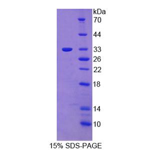 蛋白酪氨酸激酶6(PTK6)重组蛋白,Recombinant Protein Tyrosine Kinase 6 (PTK6)