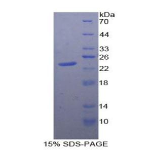 蛋白酪氨酸磷酸酶受体N(PTPRN)重组蛋白,Recombinant Protein Tyrosine Phosphatase Receptor Type N (PTPRN)