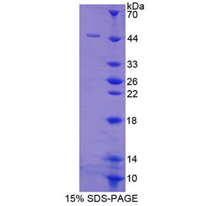 蛋白磷酸酶3调节因子亚基1(PPP3R1)重组蛋白,Recombinant Protein Phosphatase 3, Regulatory Subunit 1 (PPP3R1)