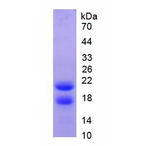 蛋白酶3(PR3)重组蛋白,Recombinant Proteinase 3 (PR3)