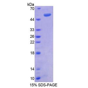 蛋白信号调节因子1(RGS1)重组蛋白