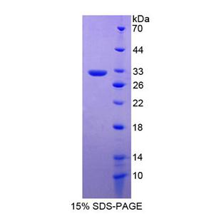 蛋白信号调节因子19(RGS19)重组蛋白