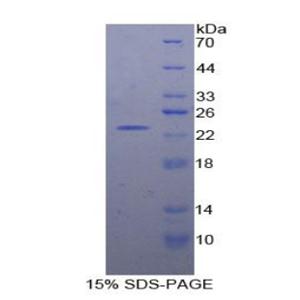 蛋白信號調(diào)節(jié)因子4(RGS4)重組蛋白