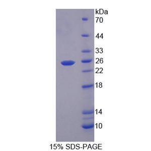 蛋白信号调节因子5(RGS5)重组蛋白,Recombinant Regulator Of G Protein Signaling 5 (RGS5)