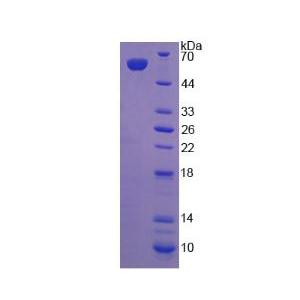 低密度脂蛋白受體相關(guān)蛋白4(LRP4)重組蛋白,Recombinant Low Density Lipoprotein Receptor Related Protein 4 (LRP4)