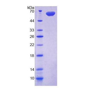 碘甲腺原氨酸脱碘酶Ⅱ(DIO2)重组蛋白