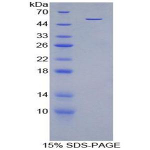 碘甲腺原氨酸脱碘酶Ⅲ(DIO3)重组蛋白