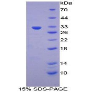 凋亡关联酪氨酸激酶(AATK)重组蛋白,Recombinant Apoptosis Associated Tyrosine Kinase (AATK)