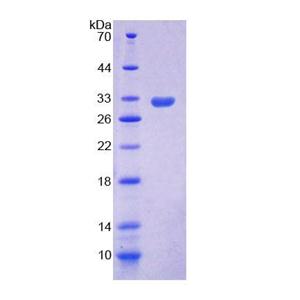 凋亡信号调节激酶I(ASK1)重组蛋白,Recombinant Apoptosis Signal Regulating Kinase 1 (ASK1)