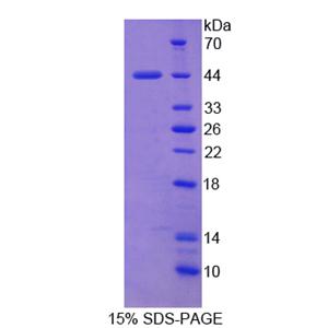 凋亡抑制因子5(API5)重组蛋白