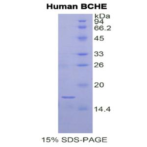 丁酰胆碱酯酶(BCHE)重组蛋白