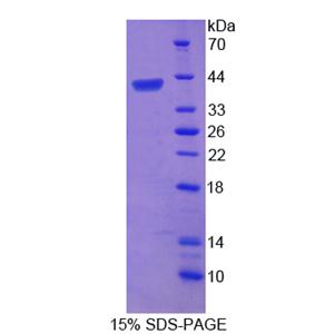 端粒重复结合因子2(TERF2)重组蛋白,Recombinant Telomeric Repeat Binding Factor 2 (TERF2)