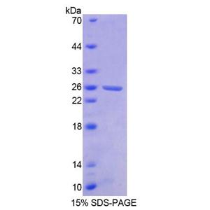 断裂点簇集群区(BCR)重组蛋白