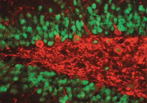 Anti-EnterobacterioPhage MS2 Coat Pr