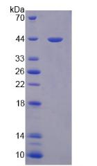 對氧磷酶3(PON3)重組蛋白,Recombinant Paraoxonase 3 (PON3)