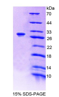 多胺氧化酶(PAOX)重组蛋白,Recombinant Polyamine Oxidase (PAOX)