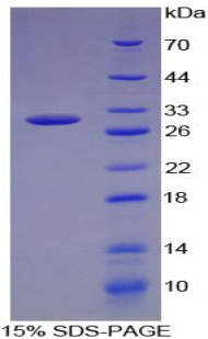 多巴胺β羟化酶(DbH)重组蛋白,Recombinant Dopamine Beta Hydroxylase (DbH)