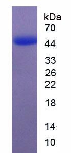 多巴胺受体D2(DRD2)重组蛋白,Recombinant Dopamine Receptor D2 (DRD2)