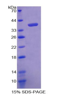 多巴胺转运蛋白(DAT)重组蛋白,Recombinant Dopamine Transporter (DAT)