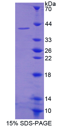 多聚A特异性核糖核酸酶(PARN)重组蛋白,Recombinant Poly A Specific Ribonuclease (PARN)