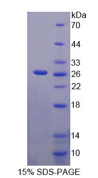 多聚蛋白2(MMRN2)重組蛋白,Recombinant Multimerin 2 (MMRN2)