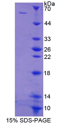 多聚嘧啶区结合蛋白1(PTBP1)重组蛋白,Recombinant Polypyrimidine Tract Binding Protein 1 (PTBP1)