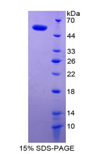 多配体蛋白聚糖1(SDC1)重组蛋白,Recombinant Syndecan 1 (SDC1)