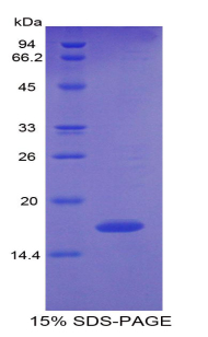 多型性腺瘤基因样蛋白1(PLAGL1)重组蛋白,Recombinant Pleiomorphic Adenoma Gene Like Protein 1 (PLAGL1)