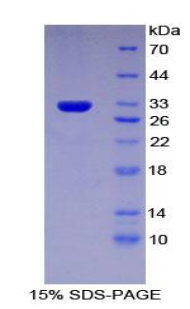 多藥耐藥關(guān)聯(lián)蛋白1(MRP1)重組蛋白,Recombinant Multidrug Resistance Associated Protein 1 (MRP1)