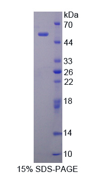 腭/肺/鼻上皮癌关联蛋白(PLUNC)重组蛋白,Recombinant Palate/Lung And Nasal Epithelium Associated Protein (PLUNC)