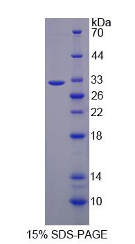 二氢嘧啶脱氢酶(DPYD)重组蛋白,Recombinant Dihydropyrimidine Dehydrogenase (DPYD)