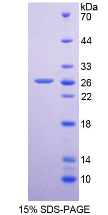 二肽基肽酶6(DPP6)重组蛋白,Recombinant Dipeptidyl Peptidase 6 (DPP6)