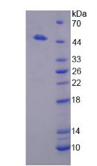 二肽酶1(DPEP1)重组蛋白,Recombinant Dipeptidase 1, Renal (DPEP1)